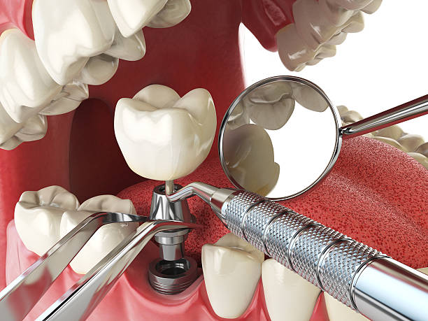 Best Tooth Infection Emergency Dentist  in Morgantown, IN
